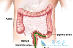 ϸ�����������ڽ�ֱ�������Ƶ�Ч����ô��