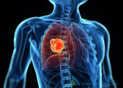 Ŀǰ����ALK���Էΰ��İ���ҩ������Щ����Ч֮����ʲô����