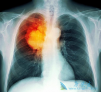 ʲô�Ƿΰ����ƣ�Сϸ���ΰ�����ʱҪע��Щʲô��