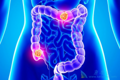 ��ֱ��������ָ�Ͻ�������(Regorafenib)�ĳ�ʼ��ҩ��������Ϊ80mg