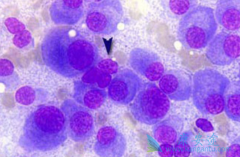 �����Ȱ�����elotuzumab�ɽ��Ͷ෢�Թ��������ߵ���������