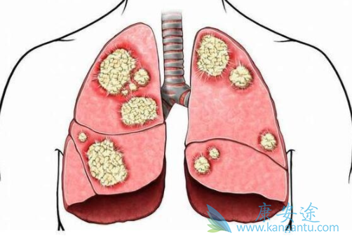 tepotinib