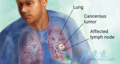 TMB��Ϊ���˵������־���ѱ�д���°�ķ�Сϸ���ΰ�ָ����