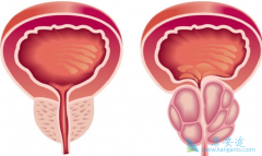 δ�������������Ƶ���֢״��ת����ǰ���ٰ���ô���ƣ�