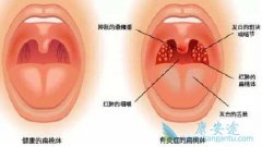 �����尩�Ĳ������������Щ֢״��