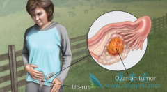 �������ѳ������ߵ�����Ӧ��ע���ӳ��޲�����