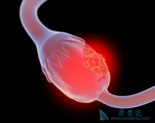 ����������������ᶼ���ӳ��ѳ����ٴο�ʼ������ʱ��