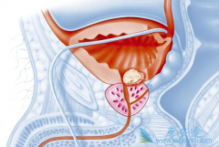 ������ǰ���ٰ�����ѡ����������ʹ������������