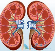 �����������ѡ���������ҩ����ܱ�֤������󻯣�