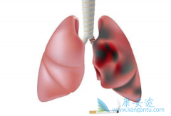 ʲô�Ƿ����۰���EGFR���Ƽ��������Ʒ����۰���