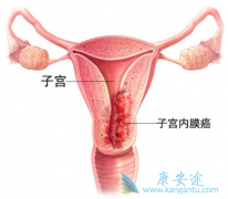 ���������������뻼������״���кܴ�Ĺ�ϵ