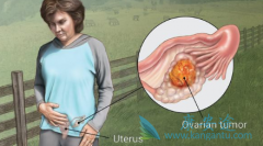 �ѳ���Ƥ���ѳ�����Ϊ������һ�ַ���