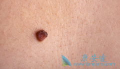 BRAF���Ƽ����������ں�ɫ���������е���ҩ����