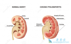 ��·��Ƥ����ҩUGN-101��FDAͻ�����Ʒ��϶�