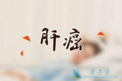 ��������(Cabometyx)���м����ΰ���չ�Ĺ�Ч