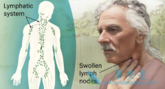 �ǻ�����ܰ�����ҩumbralisib��FDAͻ�����Ʒ��϶�