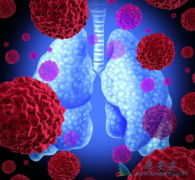 �������Ͷ������������ʲô���ƣ�