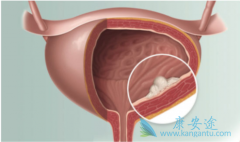 �˽���װ�������֢״�ɰ����������շ��ֲ���