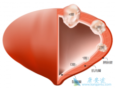 ���������ǰ��װ�����֢״��