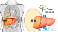 ����ֲ����������Ҫע��Щʲô���⣿