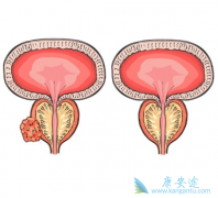 ǰ���ٰ����ڶ��ٴ�������ʲô���ã�