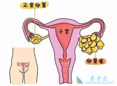 PARP���Ƽ����������ڸ������ѳ���ά�������о�����Ч�ԺͰ�ȫ��