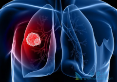 �ΰ����ƺͼ��������ĸ����ʺ�Ԥ���ΰ�������