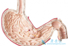 ����θ���ܻ��ã�����Щ��������ҩ����ã�