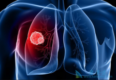 �����鵥������ͻ������ڷΰ�����Ҳ�ɽ��а�������