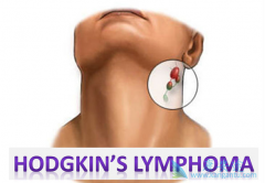 ���ڷǻ�����ܰ���ͨ��������Щ֢״���֣�