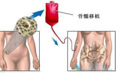 ��Ѫ��������ֲ����������������ô�죿