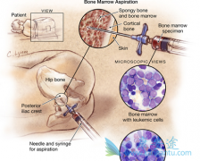 ��ֲ������෢�Թ����������ƻ���Ҫ����ҩ�︨����