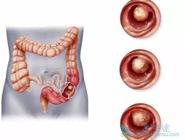 ��ֱ����