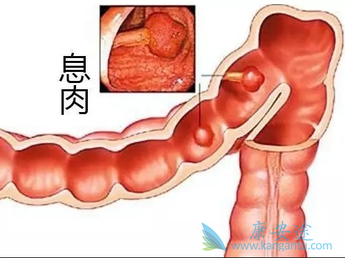 ��ֱ����