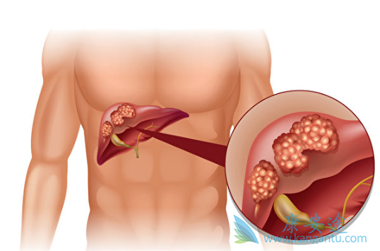 �ΰ�����