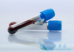 ����β���Я���߽Ӵ�һ�����Ⱦ������