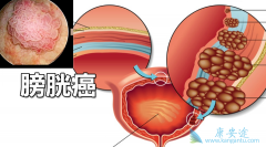 Ѫ���ǰ��װ�����֢״֮һ��