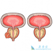 �˽�ǰ���ٰ�֢״�ɰ����������շ��ֲ���