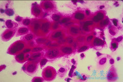 ����ɼ������˳�����ƹ�������ʲô�ô���