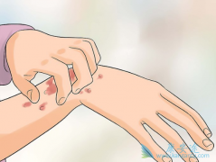 �������ɸ����ÿ��ܻ�Σ�����ߵ�Ƥ����֯����