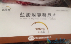 ������/�����������Ʒ�Сϸ���ΰ����ߵ���Ч��ô����