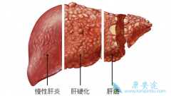 ʲô���������жϸ�Ӳ������Ӳ����ô���ƣ�