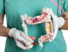 ����KRASҰ������ͻ��Ľ�ֱ����������ν��а������ƣ�