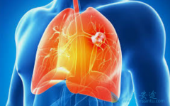 �ΰ����κ���Ӱ��ΰ�����Ч������������Щ��