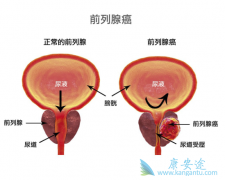 ǰ���ٰ���������Щ��ǰ���ٰ����ڶ���ǰ���ٰ�����������