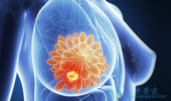 ����������T-DM1����Ƿ�������ƣ�