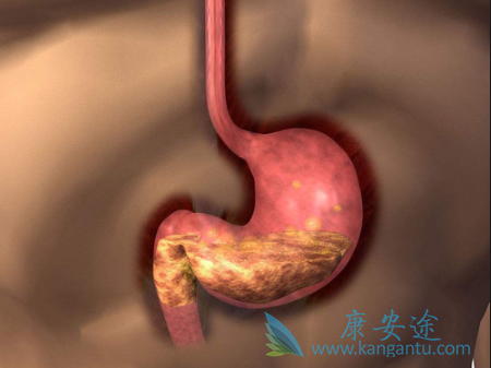 阿帕替尼 阿帕替尼