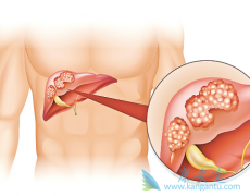 �Ҹβ�����Ⱦ�ܹ�����ԭ���Ըΰ���