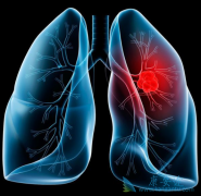 ��λ���ΰ�����֢״���Ƕ�֢���ƻ��ǿ��������ƣ�