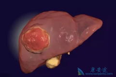 �ΰ��������κ�������ʱ��Ҫ�����ļ��㣿